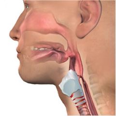 <a href="/wp-content/uploads/2019/01/pm-newsletter-v6i1.pdf#page=19">Investigación actual relacionada con la ventilación mecánica y el uso de Válvulas de Hablas</a> Doctor adjusting patient's trach